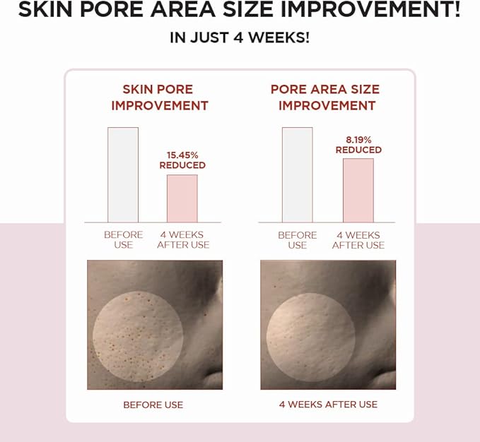Skin1004 – Madagascar Centella Poremizing Clear Toner 210ml