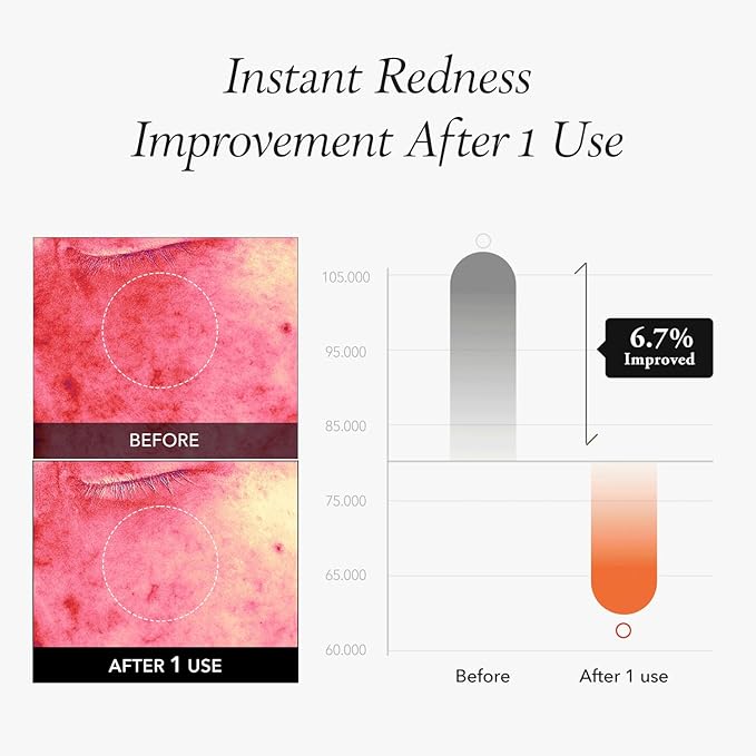 April Skin – Carrotene IPMP Instant Calming Serum Pads 80Pcs