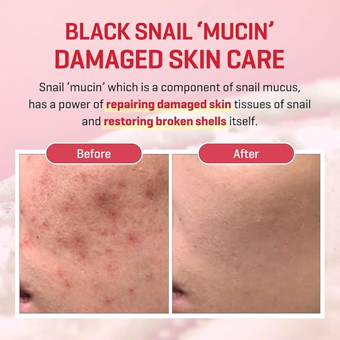 Some By Mi - Snail Truecica Miracle Repair Serum 50ml