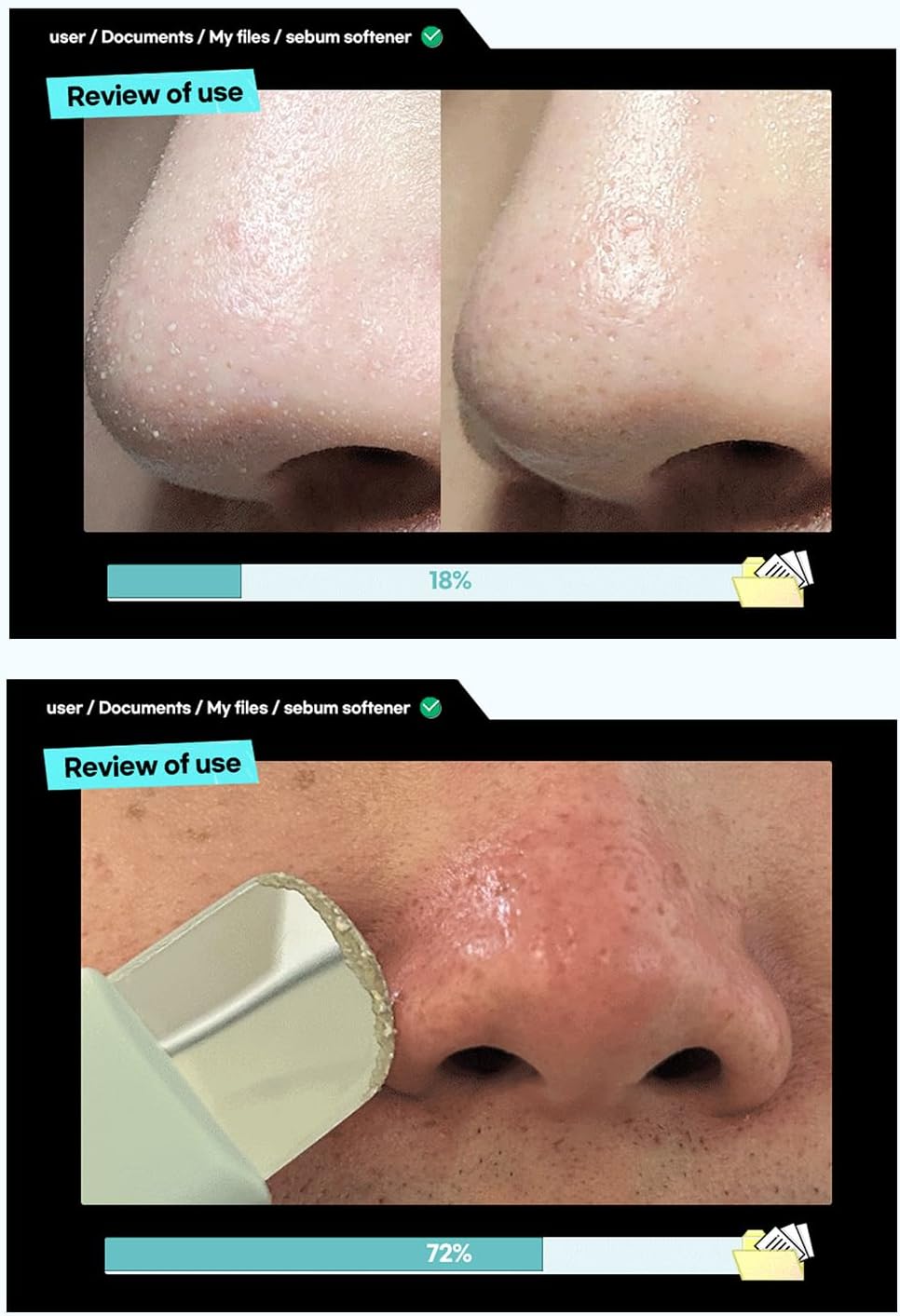 Ilso – Super melting sebum softener 150g