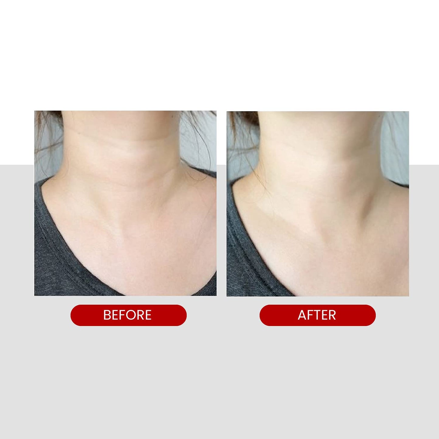 Medipeel – Premium Collagen Naite Thread Neck Cream 100ml