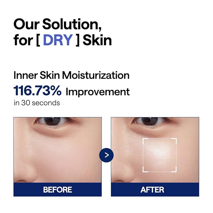 Mediheal – Watermide Moisture Pad 100 Pads