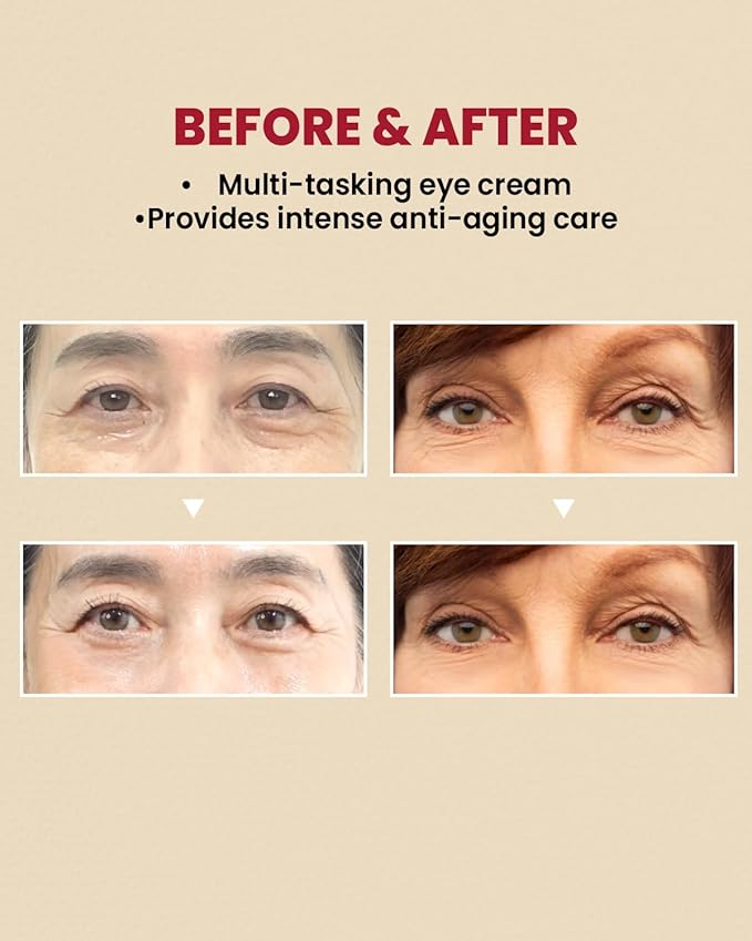 K-Secret – Seoul 1988 Retinal Liposome 4% + Fermented Bean Eye Cream 30ml
