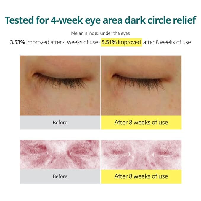 Goodal – Green Tangerine Vita C Dark Circle Eye Cream 30mL
