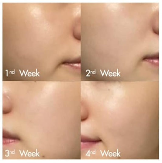 Dr. Ceuracle - Pure VC meelight Cream 20ml