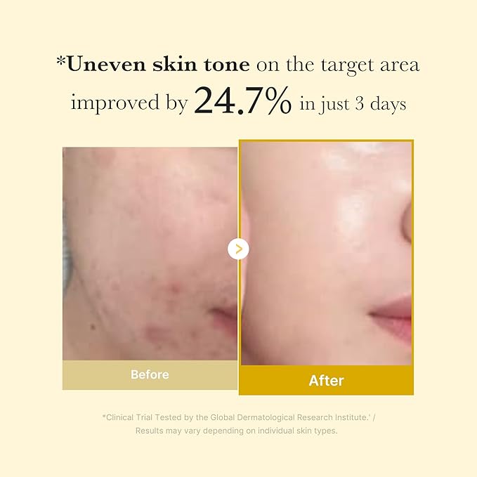 Medicube – Kojic Acid Turmeri Night Wrapping Mask 75ml