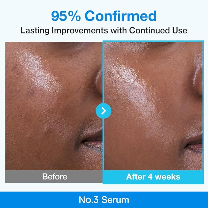 Numbuzin – No.3 Blue Bio-Retinol Pore Refining Serum 30ml
