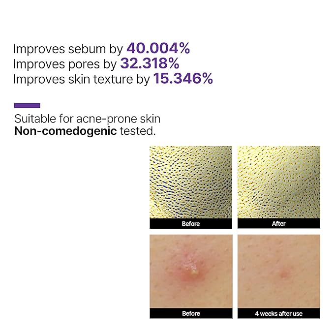 SOME BY MI – Retinol Intense Reactivating Serum 30ml