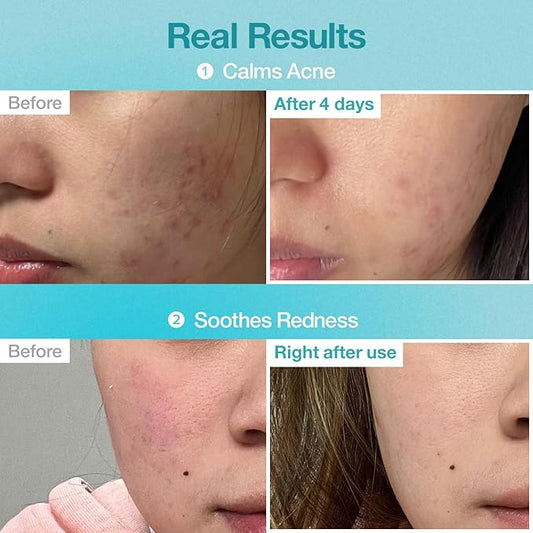 Numbuzin – No.1 Pantothenic B5+ Hyaluronic Acid Clear Mask Sheet 26ml