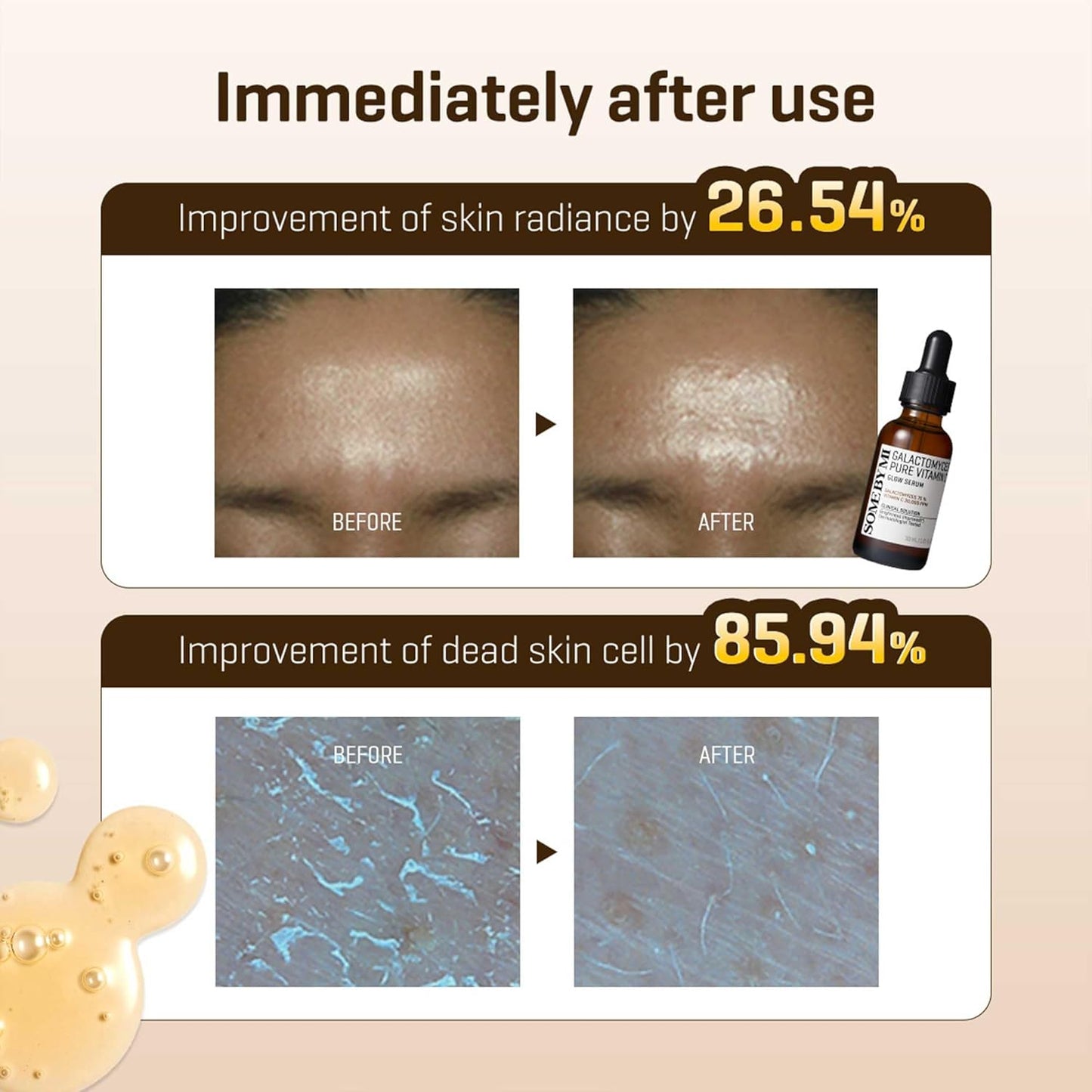 Some By Mi - Galactomyces Pure Vitamin C Glow Serum 30ml