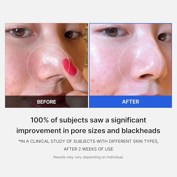 Medicube – Zero Pore Pad 2.0 (70 Pads) 155g