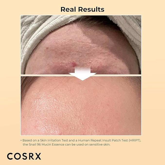 COSRX - Advanced Snail 96 Mucin Power Essence 100ml