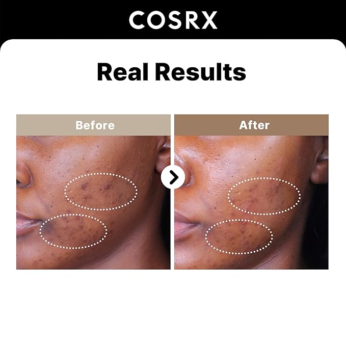 Cosrx – The Alpha-Arbutin 2 Discoloration Care 50ml