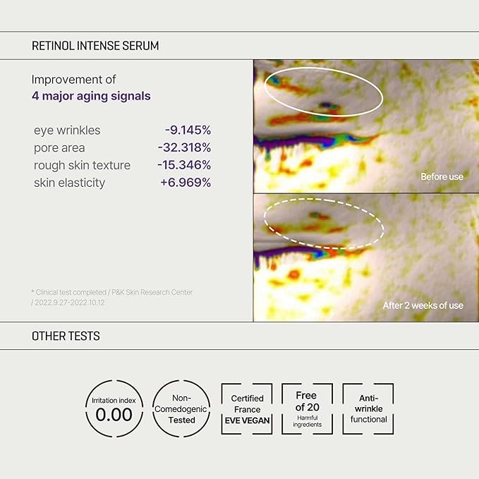 Some By Mi – Retinol Intense Trial Kit (2 Items) (10ml+10ml)