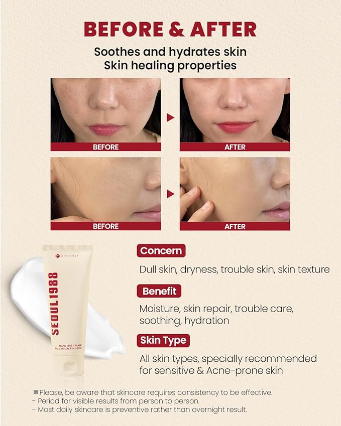 K-Secret – Seoul 1988 Snail Mucin 93% + Rice Cream 100ml