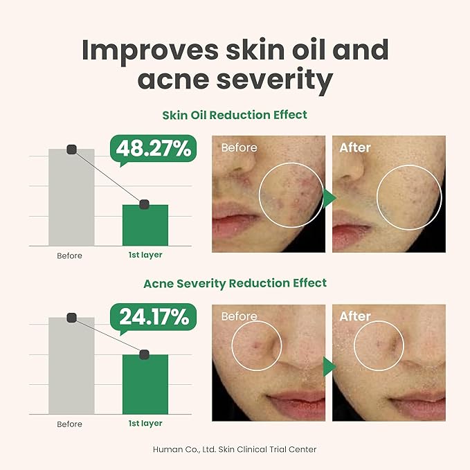AXIS-Y – Spot the Difference Blemish Treatment 15ml