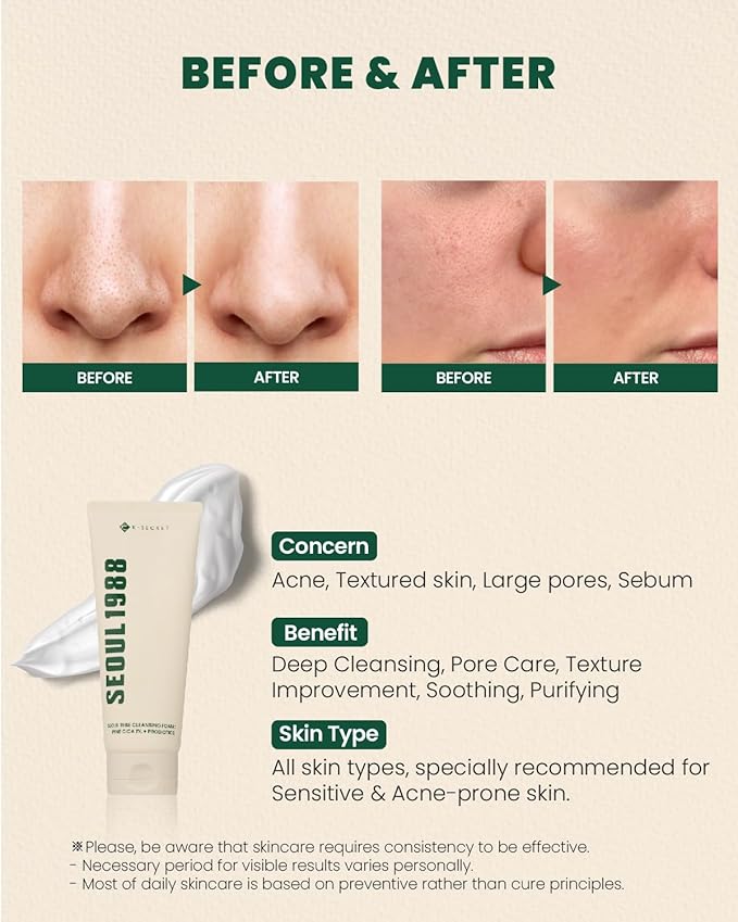 K-Secret – Seoul 1988 Pine Cica 1% + Probiotics Cleansing Foam 150ml