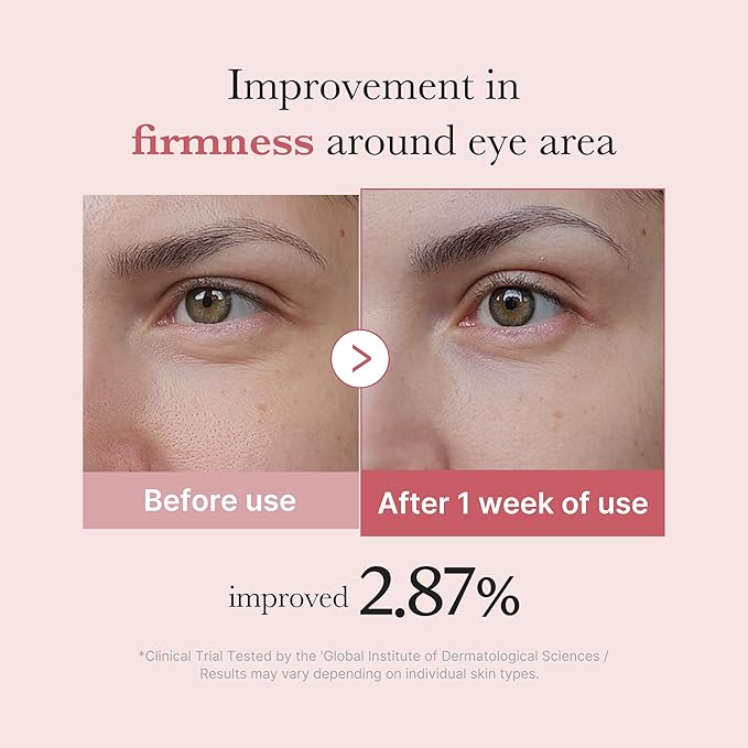 Medicube – PDRN Pink Peptide Eye Cream 30ml