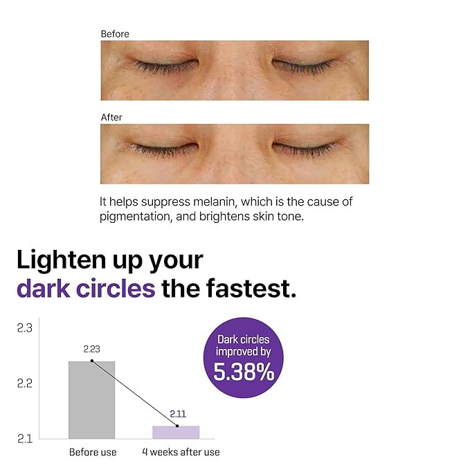 Some By Mi – Retinol Intense Advance Triple Action Eye Cream 30ml