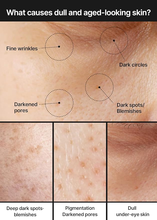 Celimax – Pore+Darkspot Brightening Cream 35ml