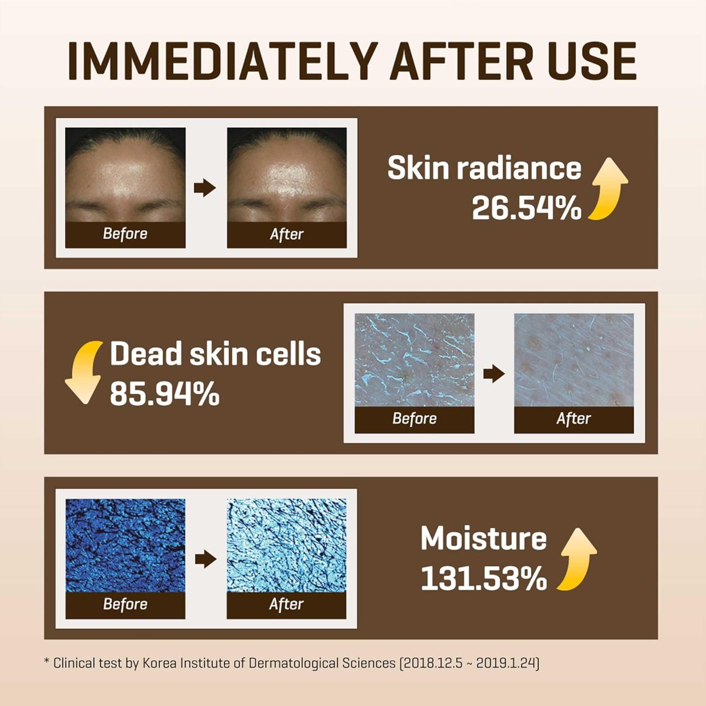 Some By Mi - Galactomyces Pure Vitamin C Glow Toner 200ml