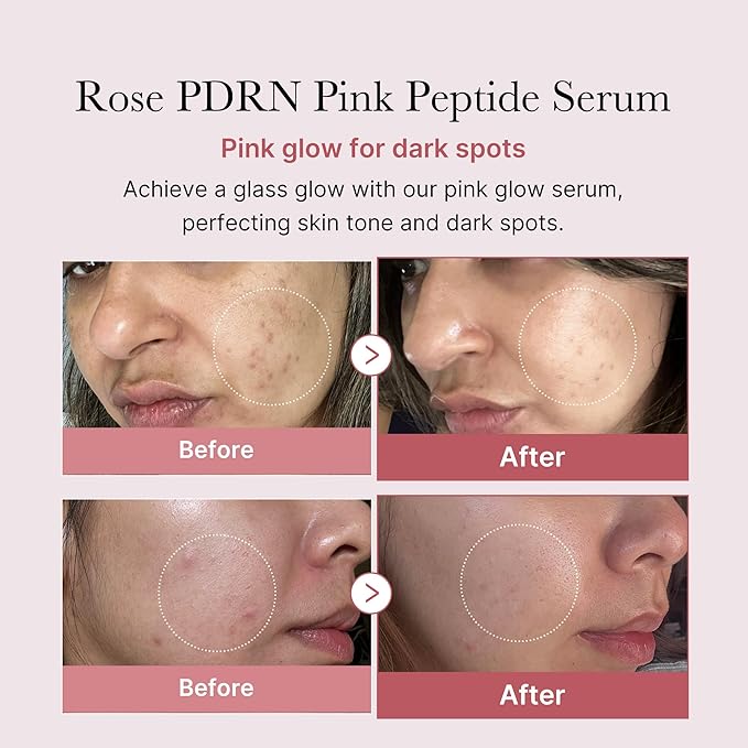Medicube – PDRN Pink Peptide Serum 30ml