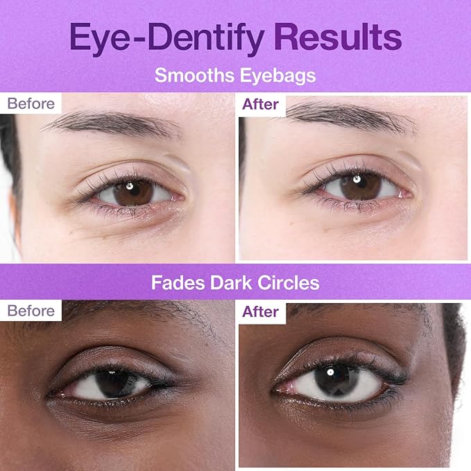 Numbuzin – No.9 NAD+ Collagen +50 Peptides Eye Patches 8g