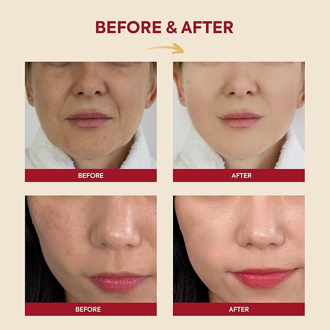 K-Secret – Snail Mucin 97% + Rice Essence 100ml
