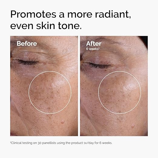 The Ordinary – Glycolic Acid 7% Exfoliating Toner 240ml