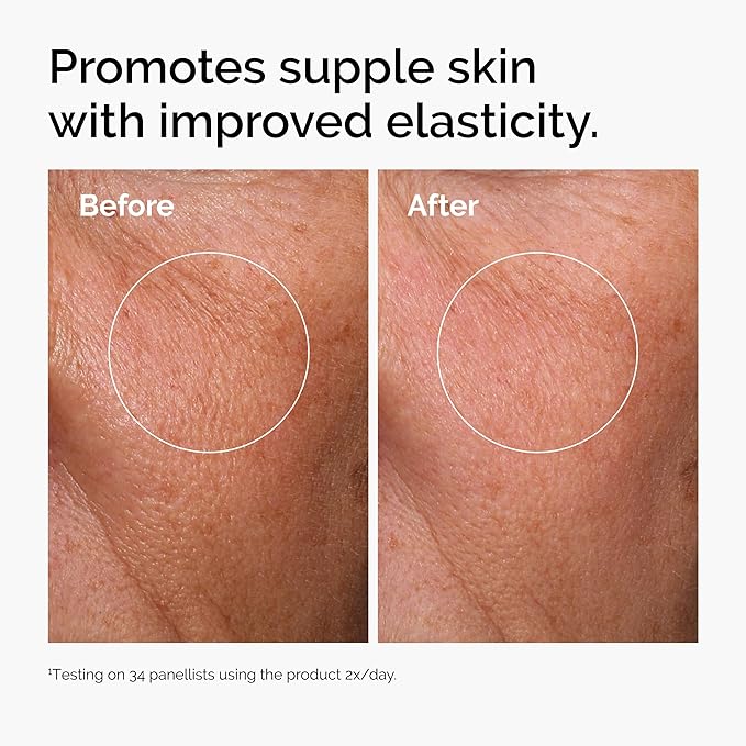 The Ordinary – Hyaluronic Acid 2 +B5 30ml