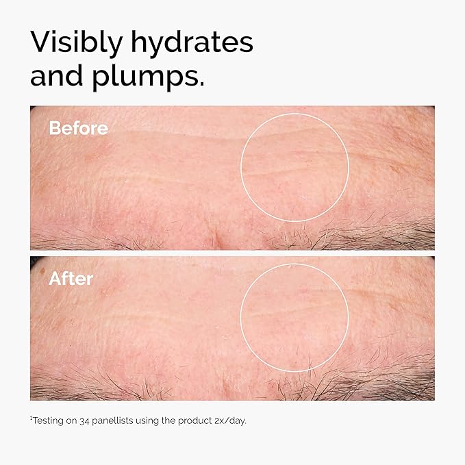 The Ordinary – Hyaluronic Acid 2 +B5 30ml