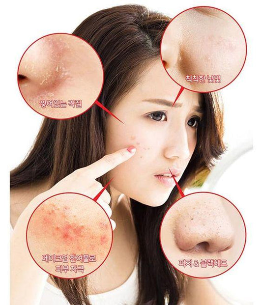 Some By Mi - AHA BHA PHA 30 Days Miracle Toner 30ml