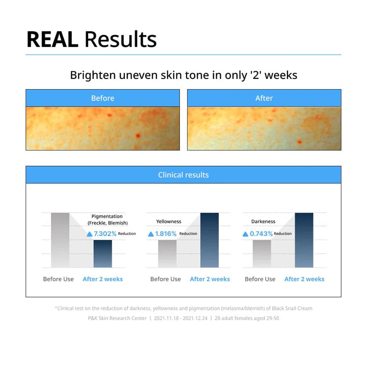 Dr. G - Black Snail Cream 50ml