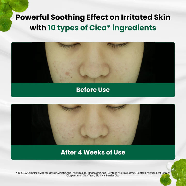 Dr.G – Red Blemish Clear Soothing Cream 50ml