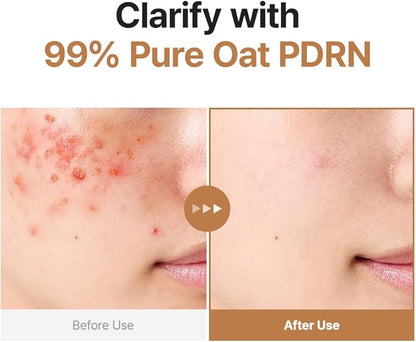 Purito – Oat PDRN Gentle Refining Toner 200ml