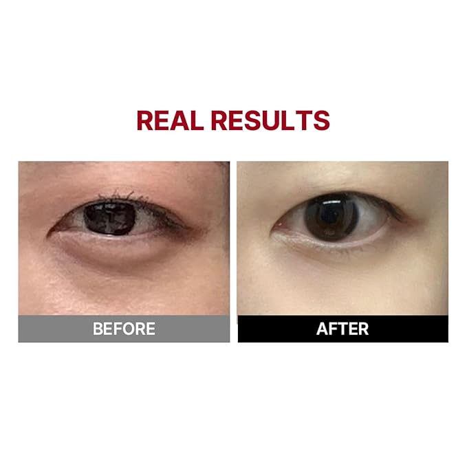 Meditherapy – Wrinkle-fit Tangle Eye Cream 20ml