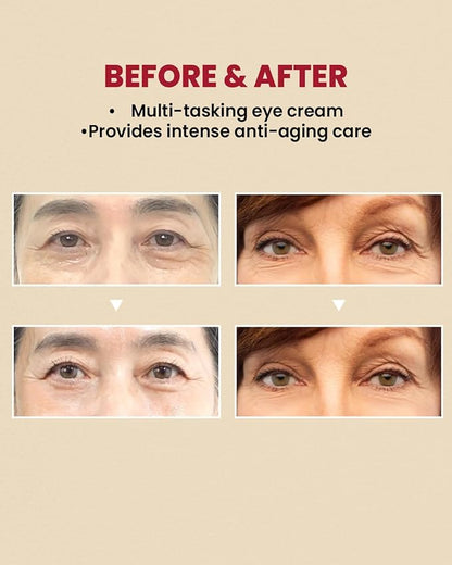 K-Secret – Seoul 1988 Retinal Liposome 4% + Fermented Bean Eye Cream 30ml
