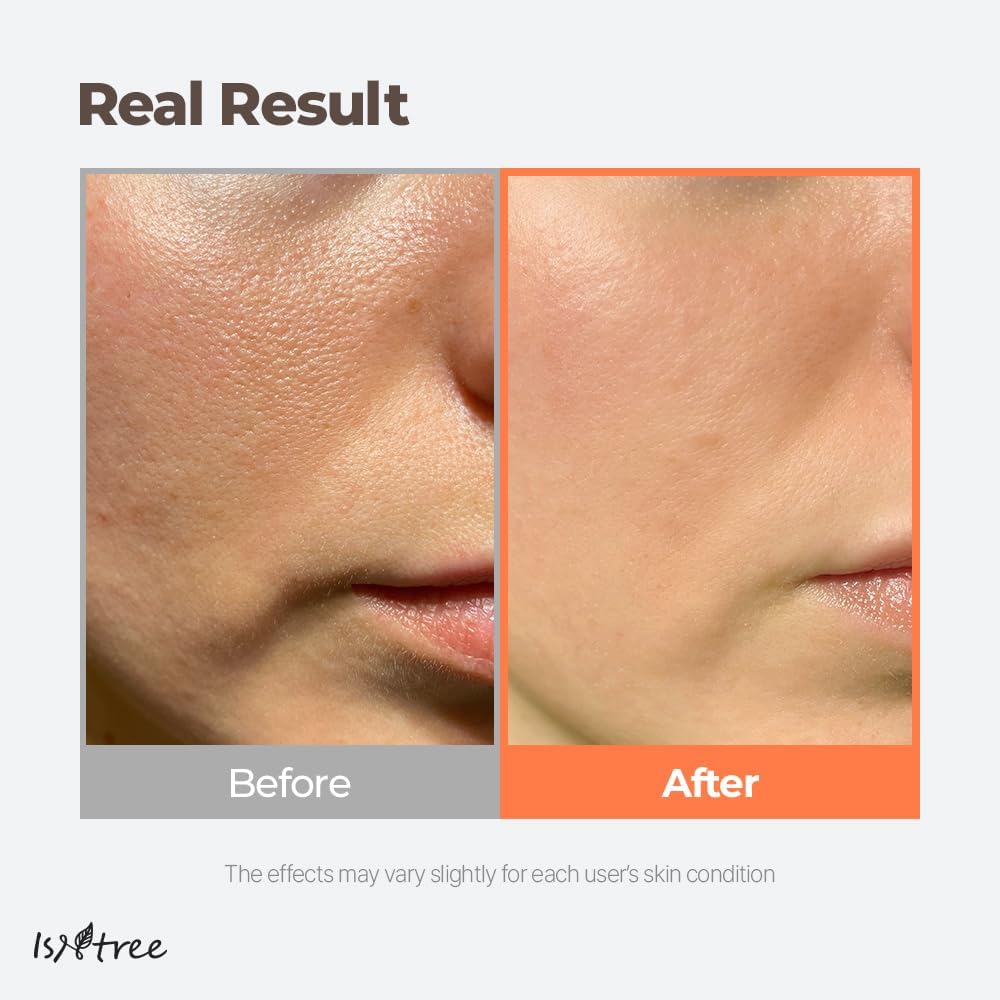 Isntree – Green Tea Fresh Toner 200ml