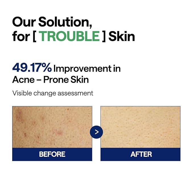 Mediheal – Tea Tree Trouble Pad 100 Pads