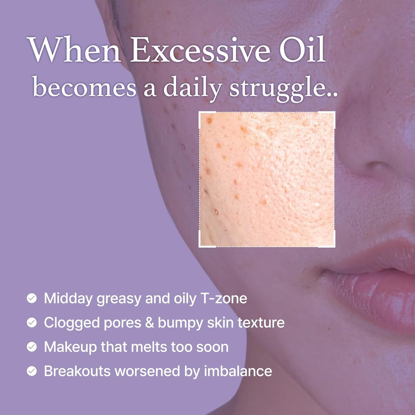 I’m From – Black Rice Toner 150ml