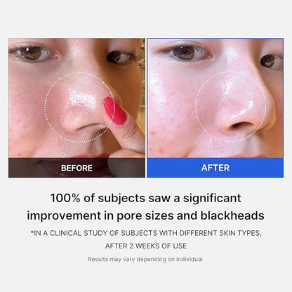 Medicube – Zero Pore Pad 2.0 (70 Pads) 155g