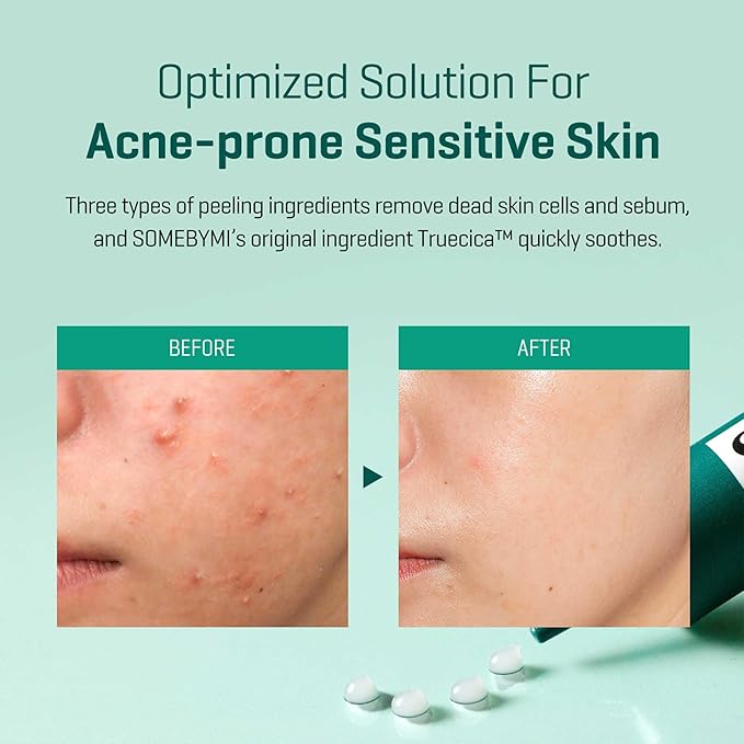 Some By Mi – AHA BHA PHA 14 Days Super Miracle Spot All Kill Cream 30ml