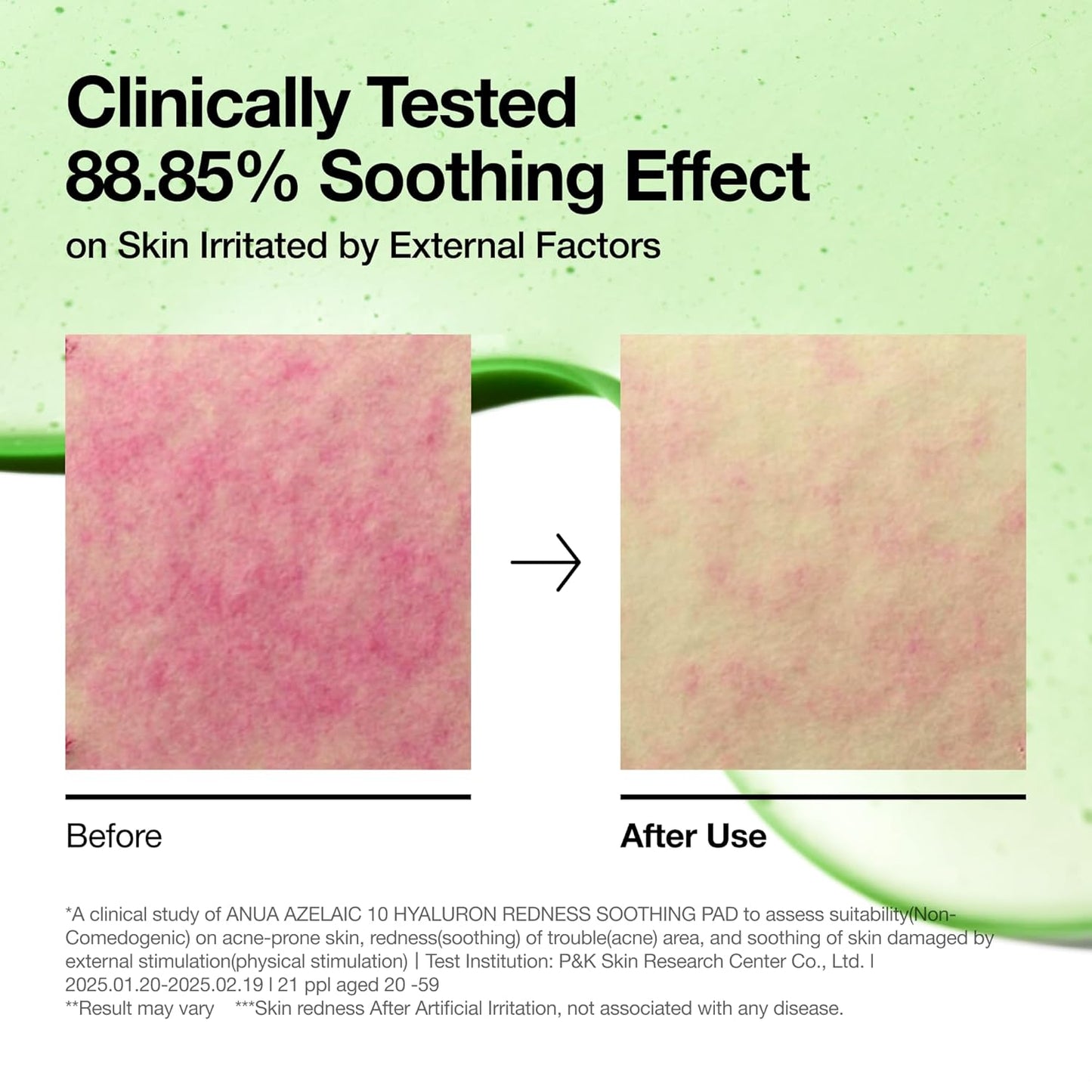 Anua - Azelaic 10 Hyaluron Redness Soothing Pad