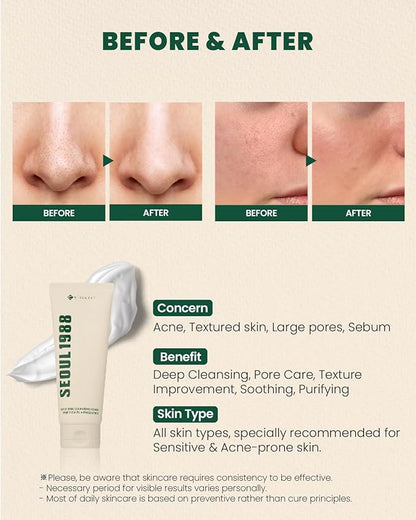 K-Secret – Seoul 1988 Pine Cica 1% + Probiotics Cleansing Foam 150ml