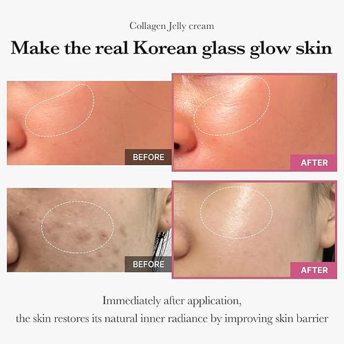 Medicube – Collagen Jelly Cream 110ml Hover