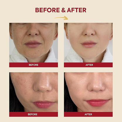 K-Secret – Snail Mucin 97% + Rice Essence 100ml
