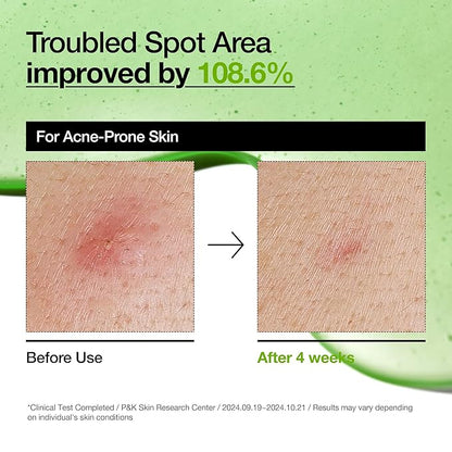 Anua – Azelaic Acid 10 Hyaluron Redness Soothing Serum