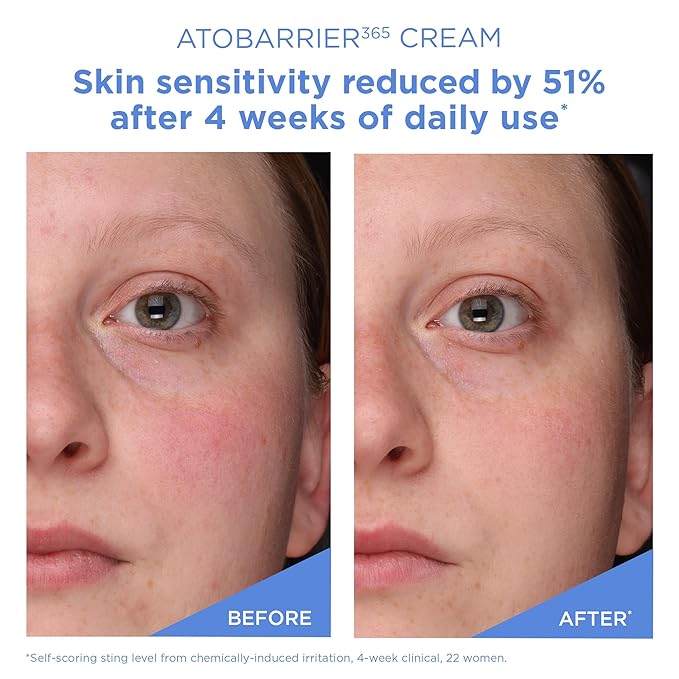 Aestura – Atobarrier 365 Cream 30ml