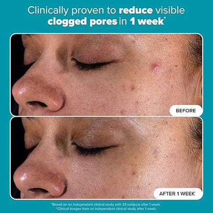 Paula’s Choice – Skin Perfecting BHA Liquid Exfoliant 30ml (Korean Version)