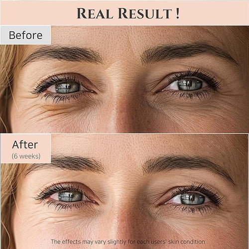 Beauty Of Joseon - Revive eye serum : Ginseng + Retinal 30ml Hover